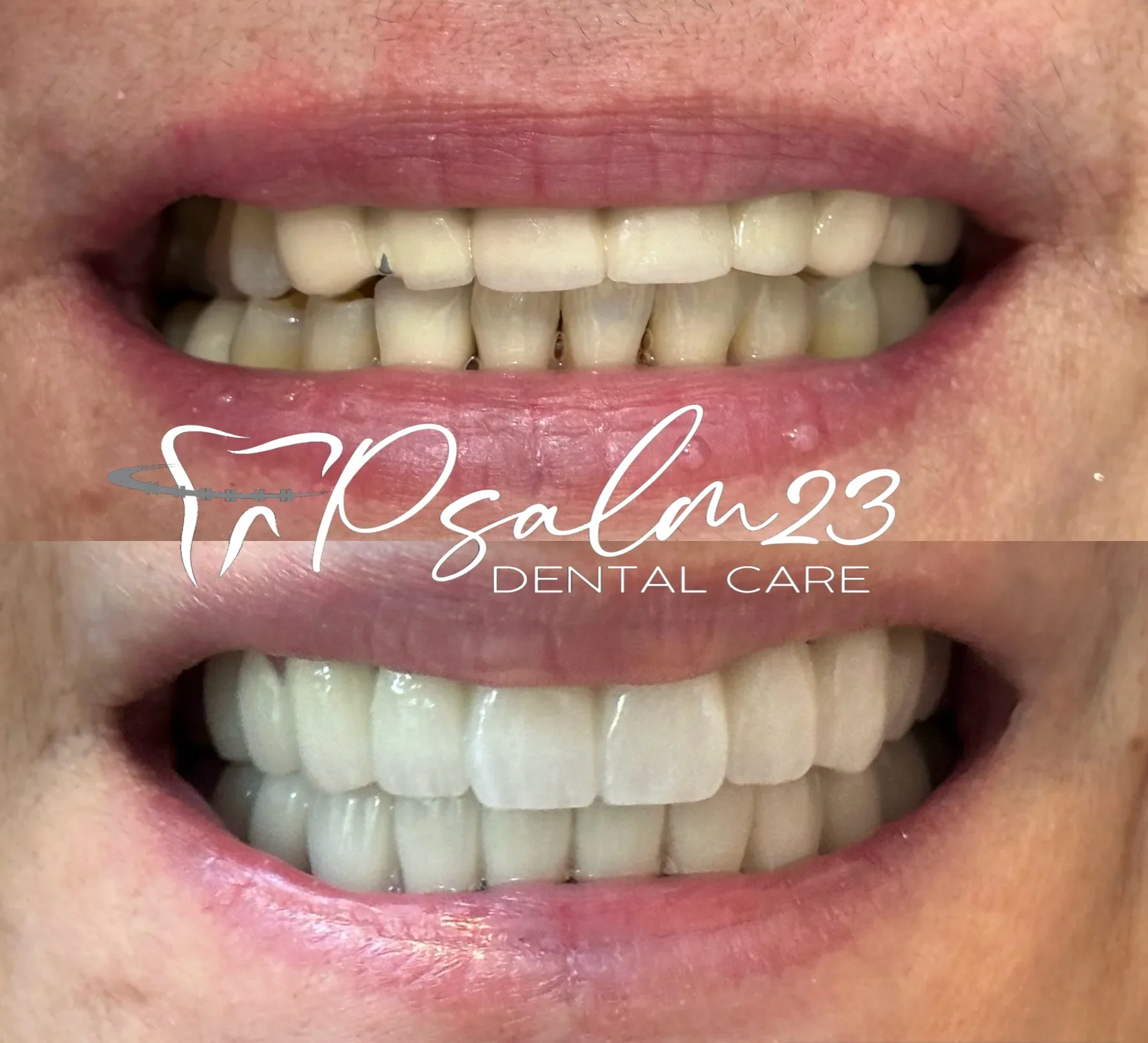 Psalm23 Dental Care cosmetic dentistry services — photo 4